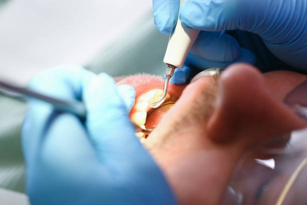 Best Broken or Chipped Tooth Repair in Hamlin, TX
