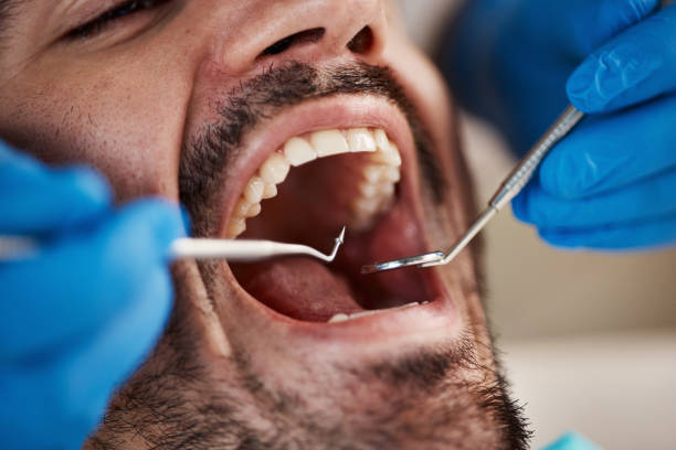 Best Dental Abscess Treatment in Hamlin, TX